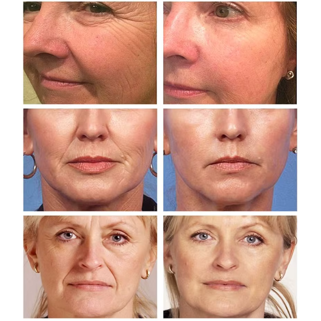 Mamushi ARG® Serum 15ml - Botox Effect Ορός με Argireline