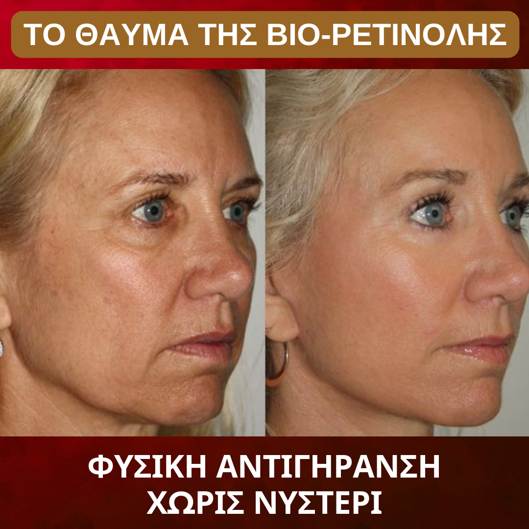 Bakuchiol BioRetinol - Αντιγηραντική Κρέμα Νυκτός