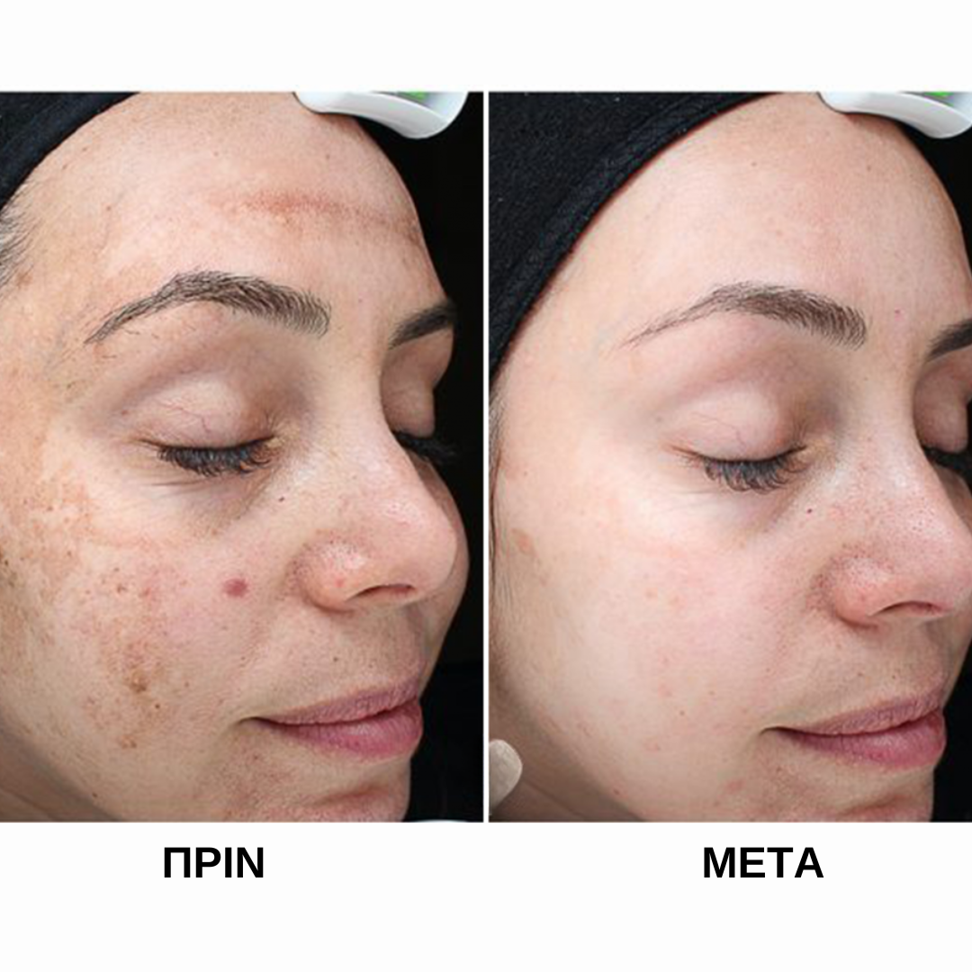 Rice Facial Scrub 100 ml - Πίλινγκ Προσώπου με Ρύζι